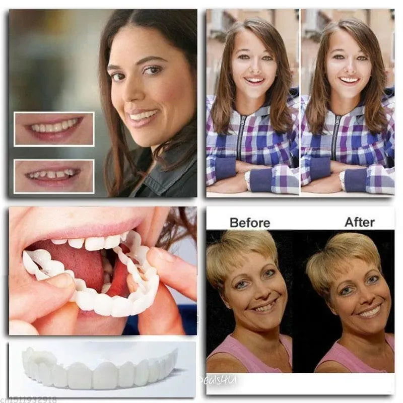 Adjustable Snap-On Dentures - Lenepot -  -  -  - #tag1# - #tag2# - #tag3# - #tag4#